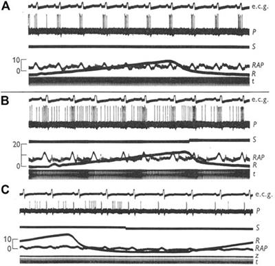 Multiple sensor theory in cardiovascular mechanosensory units